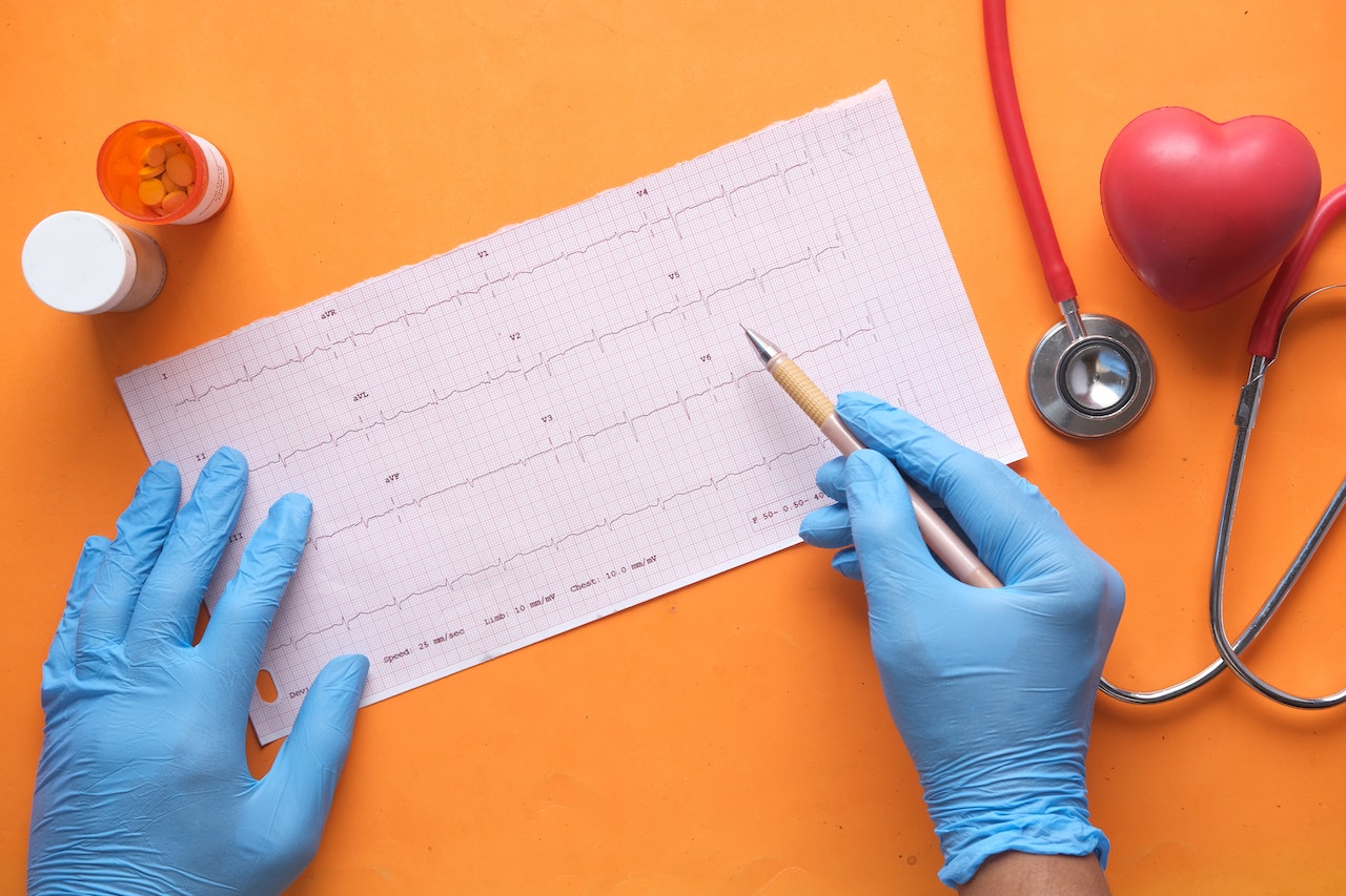 Badanie EKG – jak się do niego przygotować?